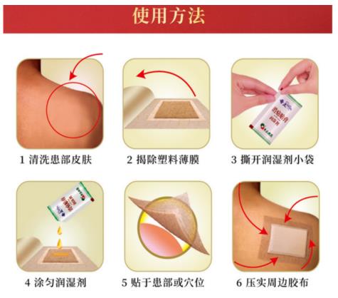 奇正消痛貼膏治療上有什么特別之處嗎？