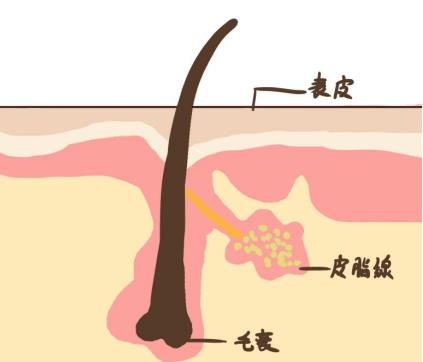 臉上長(zhǎng)痘如何快速祛痘？