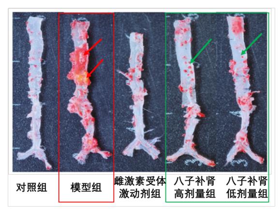 以嶺藥業(yè)八子補(bǔ)腎膠囊抗衰老研究取得重大進(jìn)展