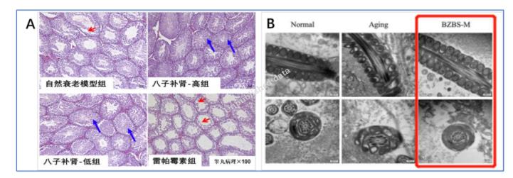 以嶺藥業(yè)八子補(bǔ)腎膠囊抗衰老研究取得重大進(jìn)展