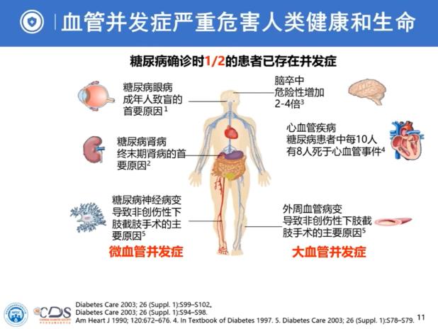 專家權威解讀｜糖尿病并發(fā)癥——隱藏在糖尿病背后的“殺手”