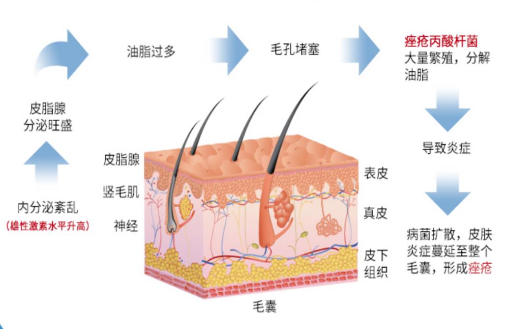 毛囊炎引起的細(xì)菌感染怎么辦