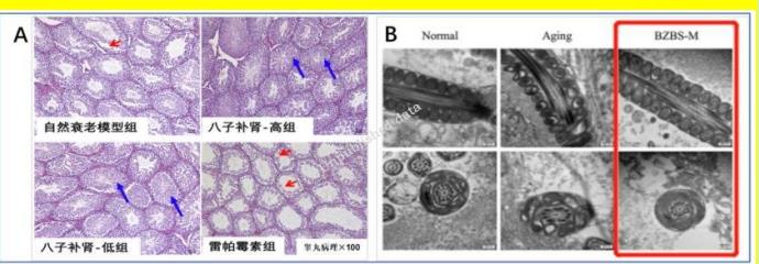 治療男性早泄，八子補(bǔ)腎膠囊用藥方法是什么