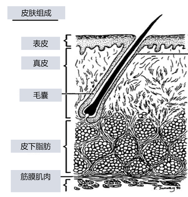 刮完胡子如何防止毛囊炎？這個方法可以一試