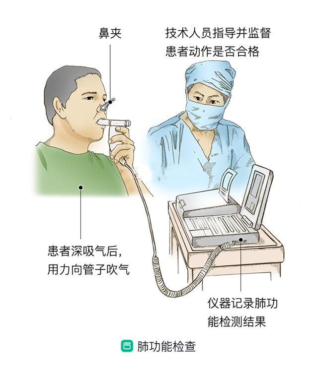 你的肺功能怎么樣？測一下吧